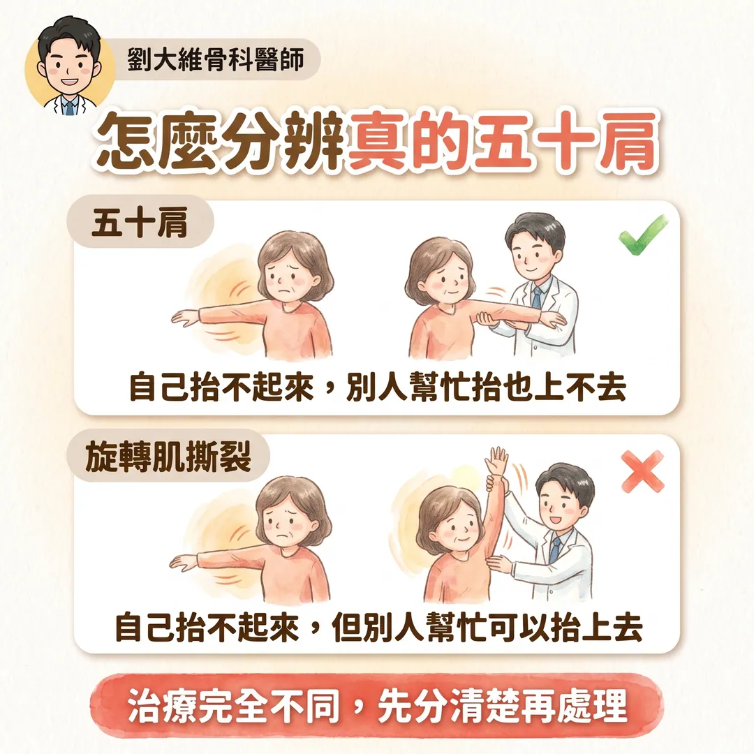 五十肩無聲鬆動術（Silent Manipulation）完整整理 衛教圖 3