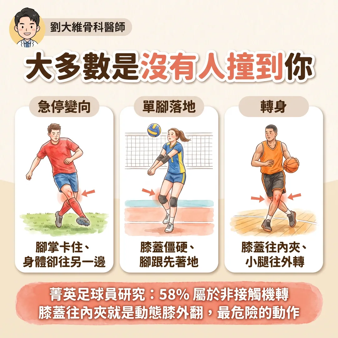 膝蓋「啪」一聲就腫起來？前十字韌帶撕裂：為什麼會受傷、什麼人需要開刀 衛教圖 3