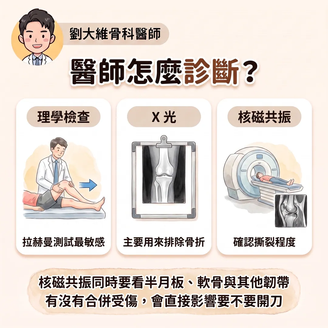 膝蓋「啪」一聲就腫起來？前十字韌帶撕裂：為什麼會受傷、什麼人需要開刀 衛教圖 6
