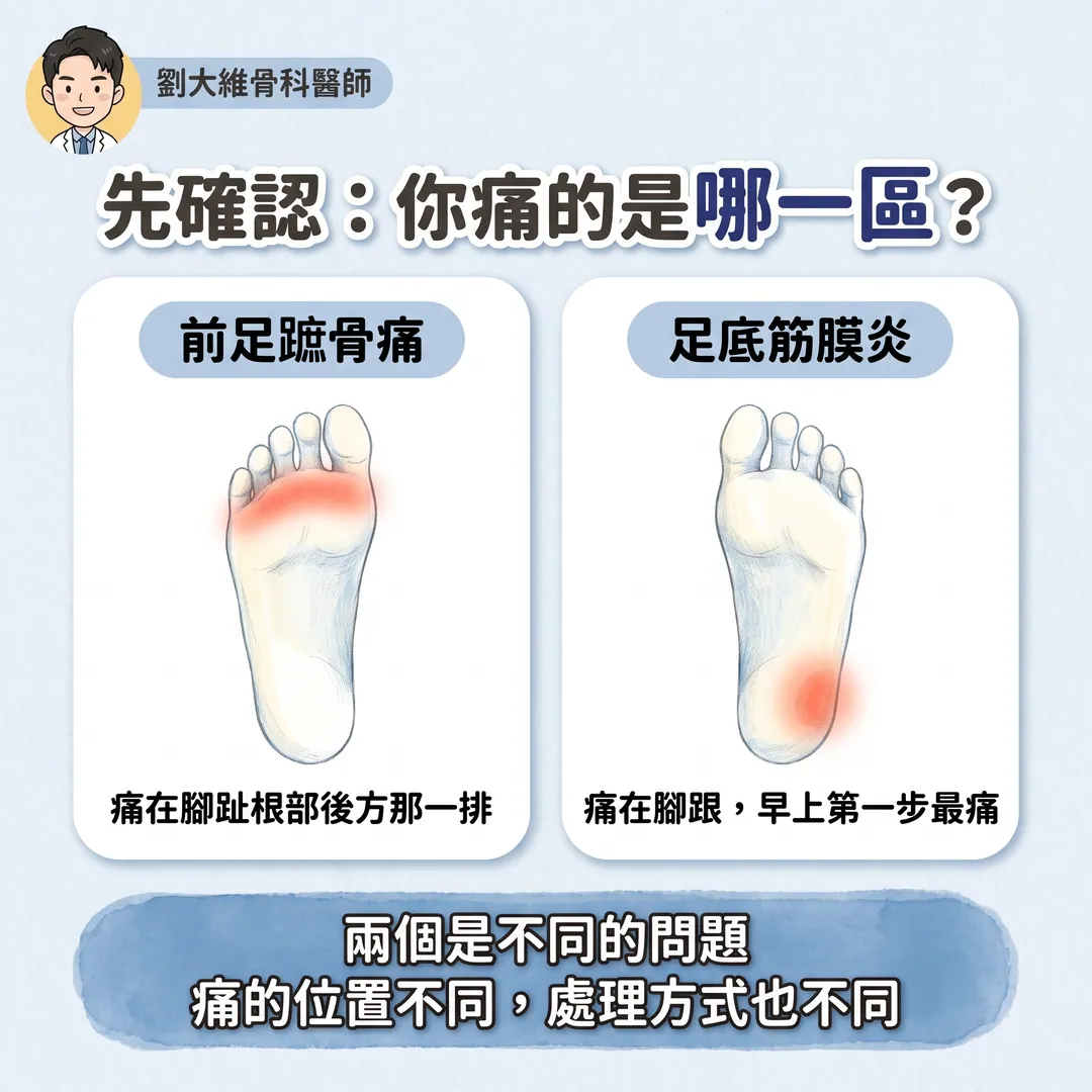 前足蹠骨痛（Metatarsalgia）的原因與治療 衛教圖 2