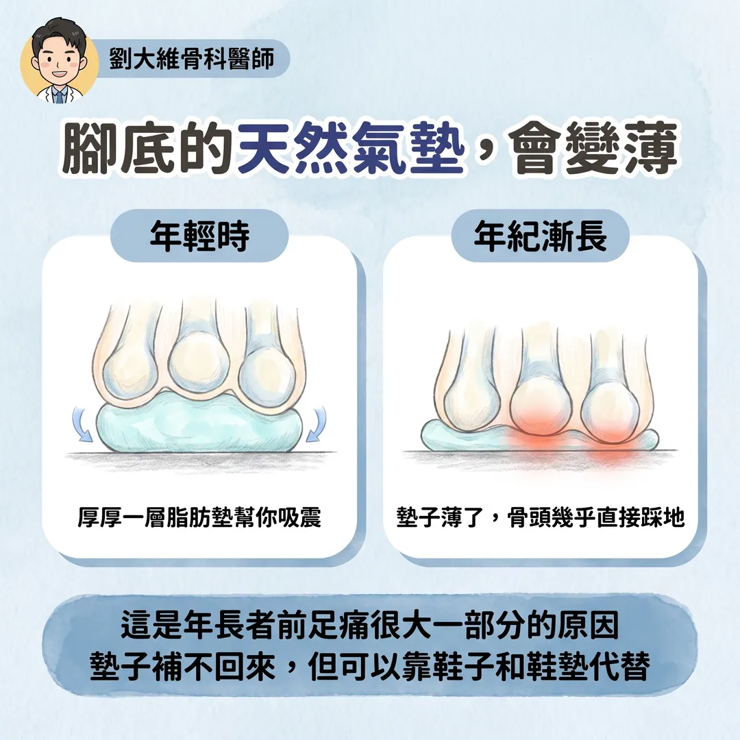 前足蹠骨痛（Metatarsalgia）的原因與治療 衛教圖 5