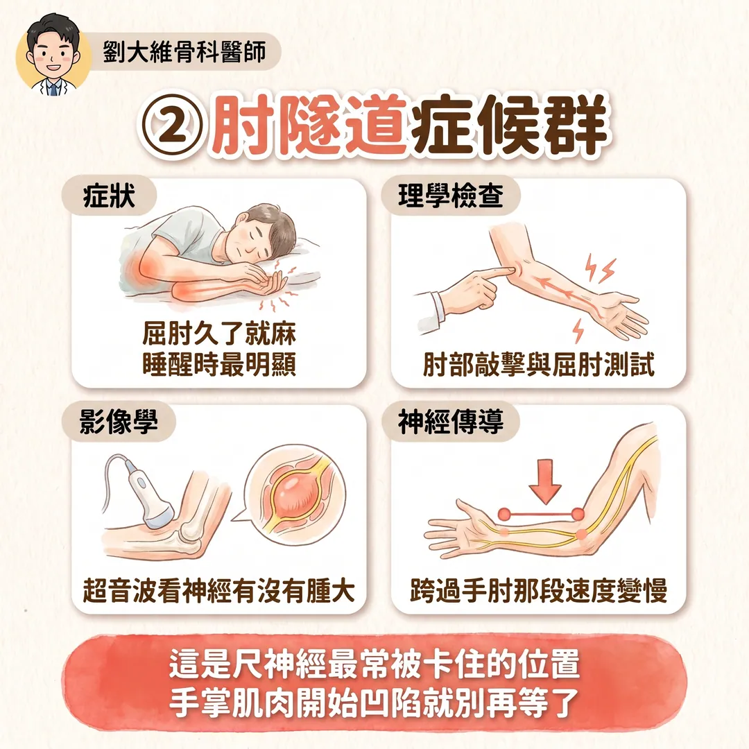 小指與無名指麻木的鑑別診斷 衛教圖 5