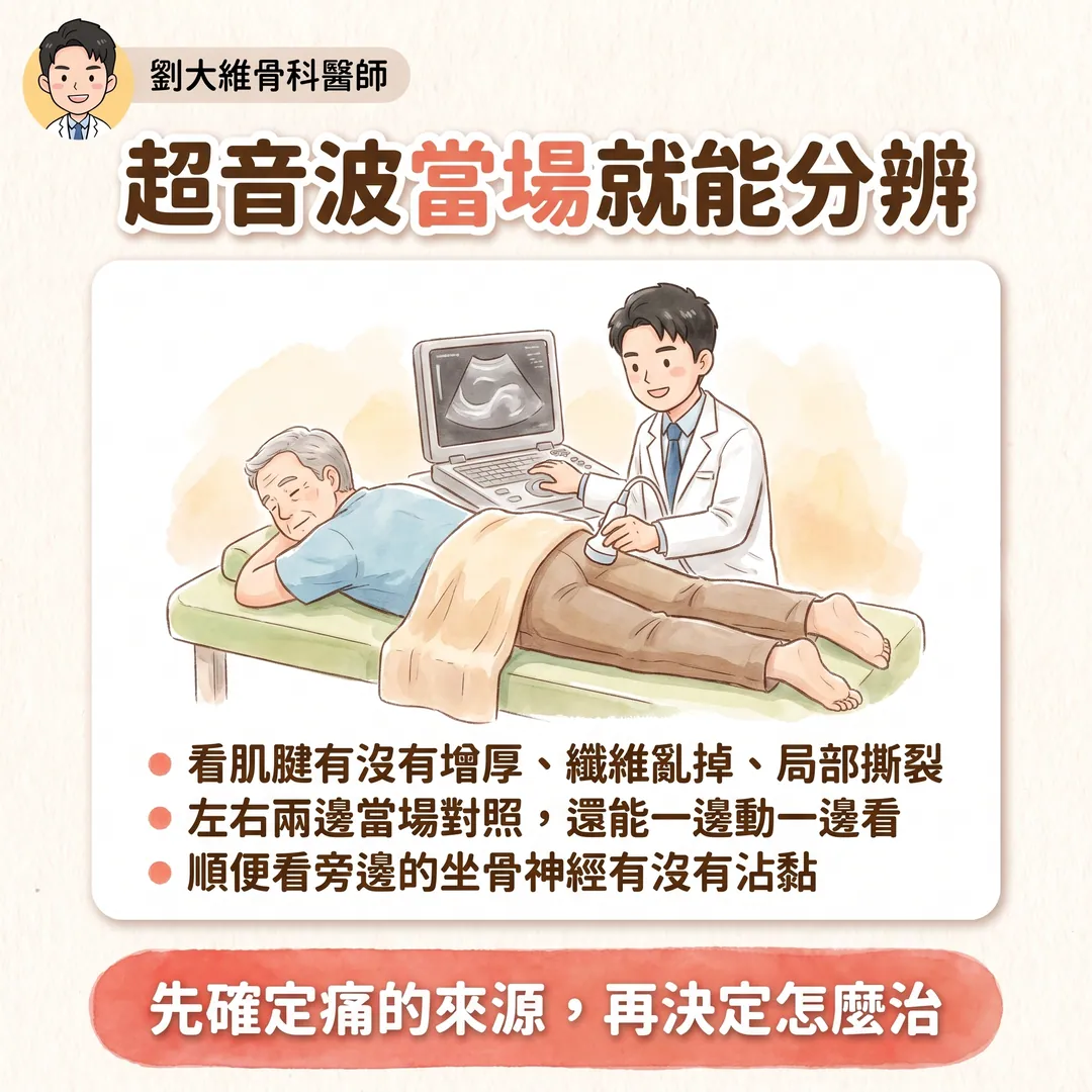 近端腿後肌腱病變（高位腿後肌拉傷）為什麼常被誤診為腰椎椎間盤突出 衛教圖 8