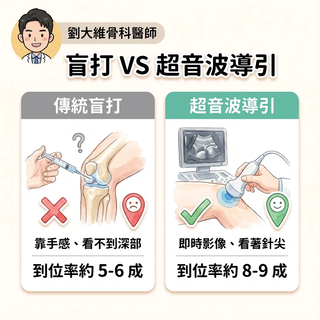 為什麼疼痛治療要用「超音波導引注射」？骨科醫師告訴你關鍵差別 衛教圖 3