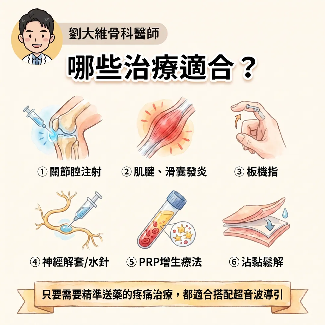 為什麼疼痛治療要用「超音波導引注射」？骨科醫師告訴你關鍵差別 衛教圖 7