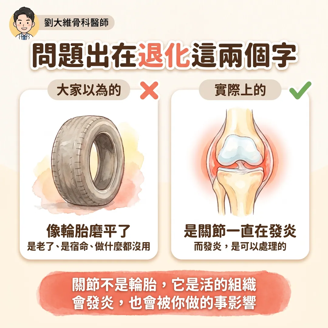 退化性關節炎：或許重點不是退化，而是發炎 衛教圖 2