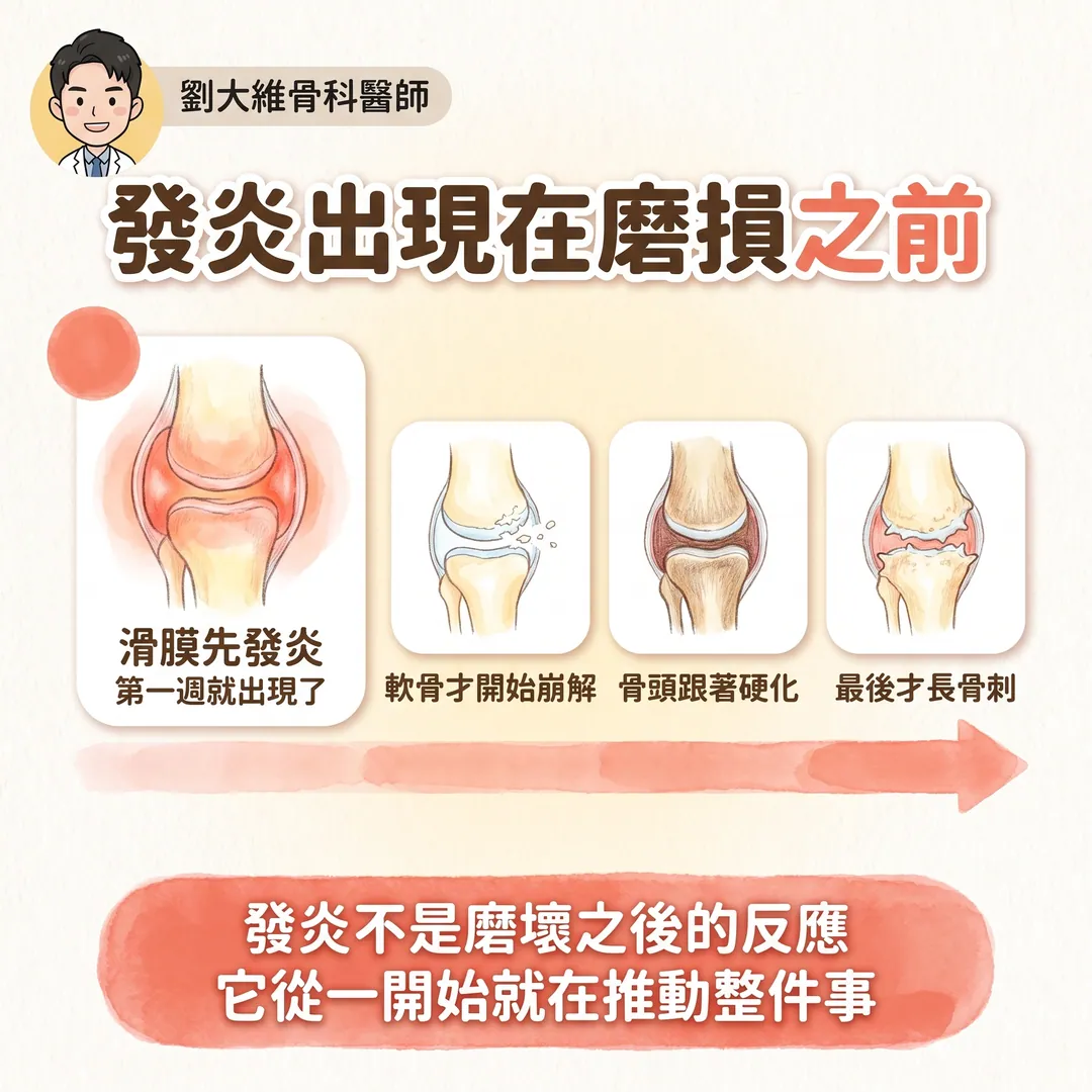 退化性關節炎：或許重點不是退化，而是發炎 衛教圖 4