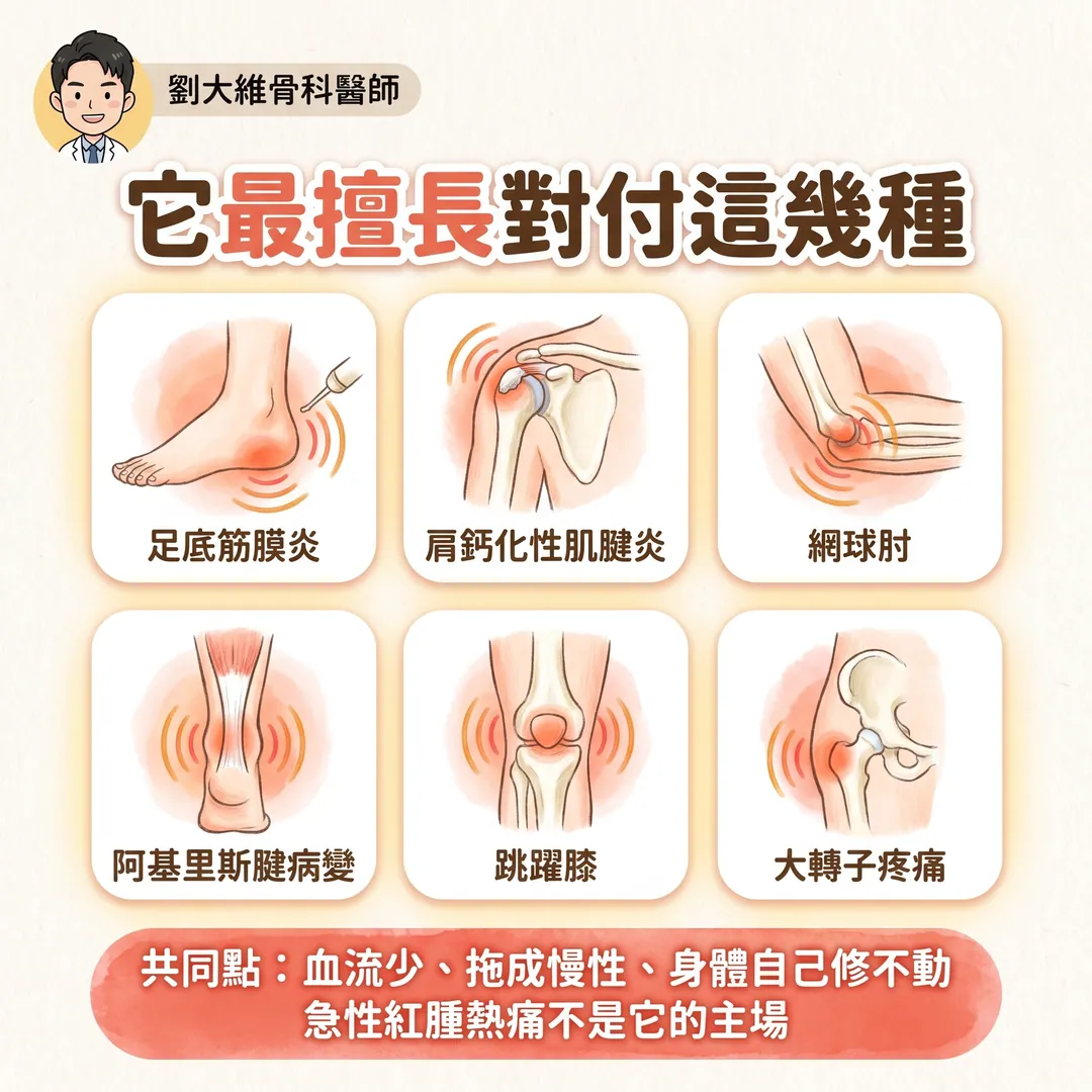 震波治療（ESWT）完整整理：原理、適應症、以及骨不癒合與骨壞死的應用 衛教圖 6