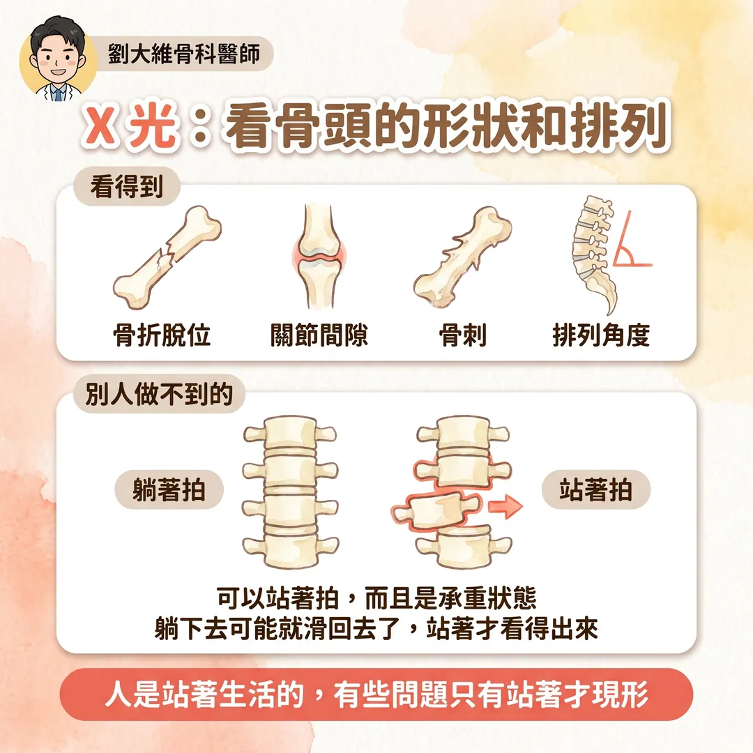 骨科影像金三角：X 光、超音波、MRI 各自看什麼、優缺點 衛教圖 3