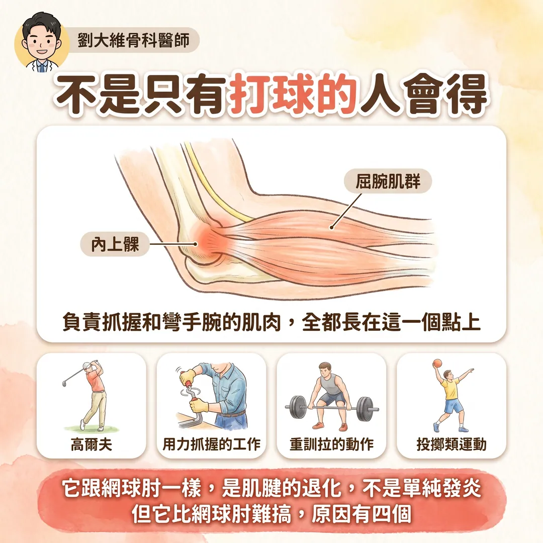 高爾夫球肘（內上髁肌腱病變）：為什麼比網球肘難治 衛教圖 2