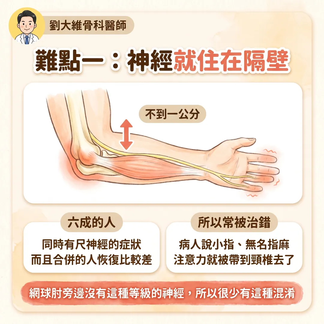 高爾夫球肘（內上髁肌腱病變）：為什麼比網球肘難治 衛教圖 3