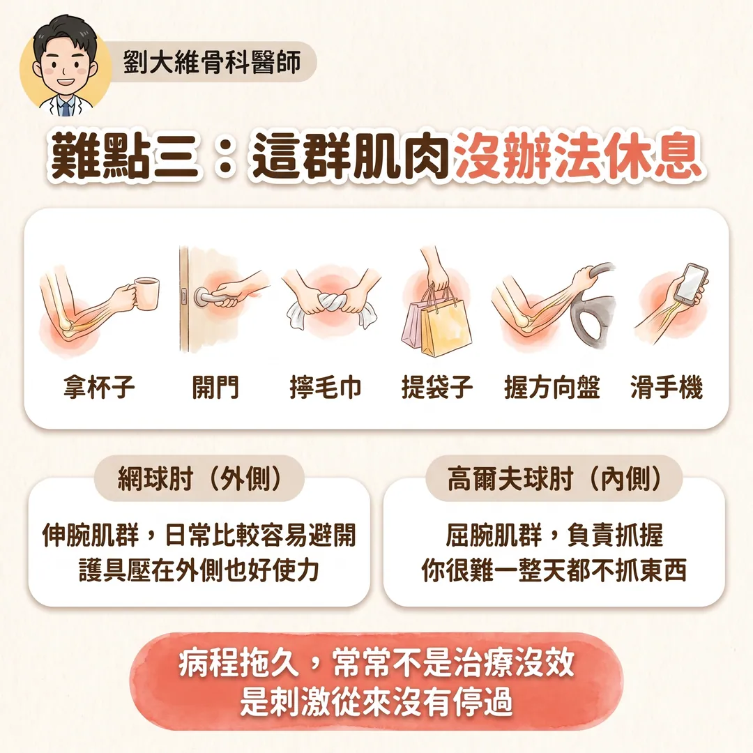 高爾夫球肘（內上髁肌腱病變）：為什麼比網球肘難治 衛教圖 5