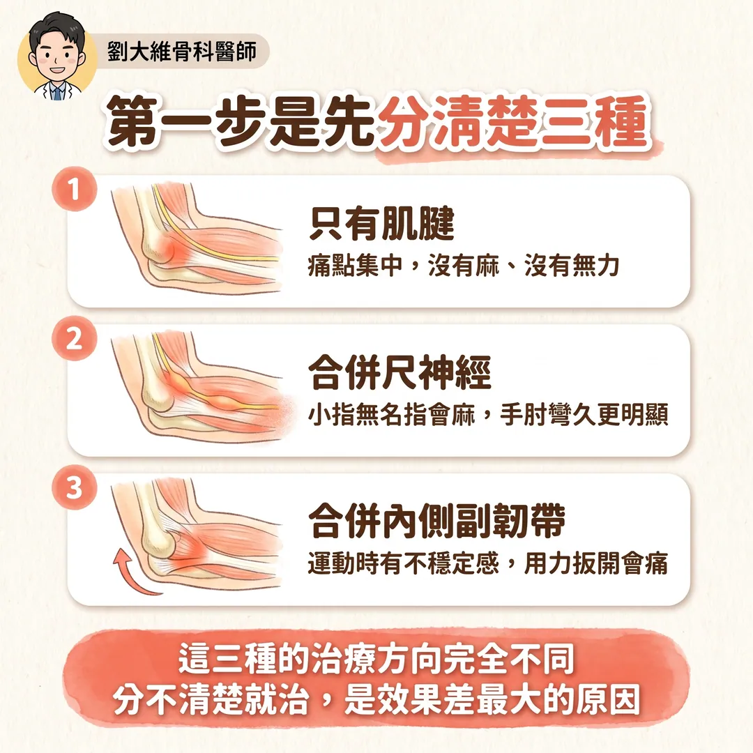 高爾夫球肘（內上髁肌腱病變）：為什麼比網球肘難治 衛教圖 7